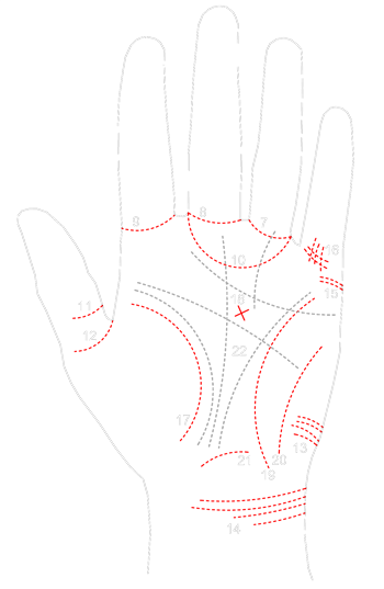 lineas secundarias menores de la mano